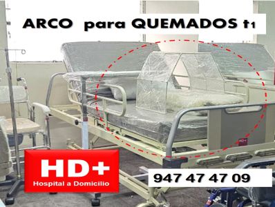 ARCO para QUEMADOS t1