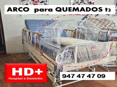 ARCO para QUEMADOS t2