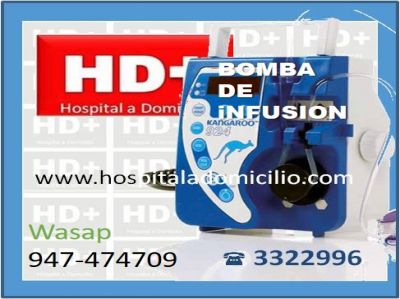Bomba de Alimentación