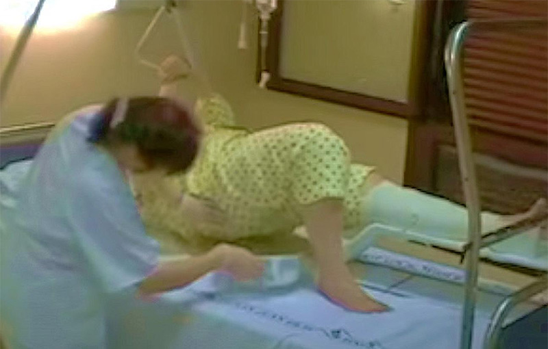 Fractura de Cadera en Mujeres Mayores y la Importancia de la Chata Pico de Pato
